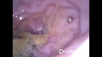 Show Inside Of My Ass With Endoscope [FullHD 1080p / mp4 / 378 MB]