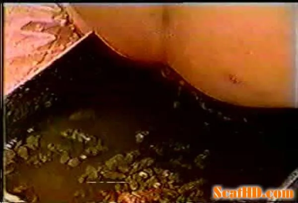 Amateur -.rar e Scat Enema [DVDRip / .mpg / 265 MB]