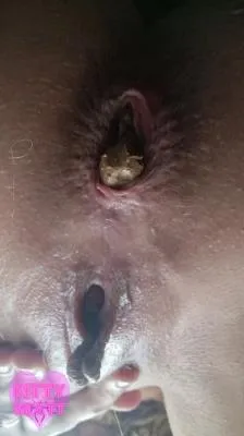 Online Festival Constipation [SD / mp4 / 517 MB] scat-hub.com